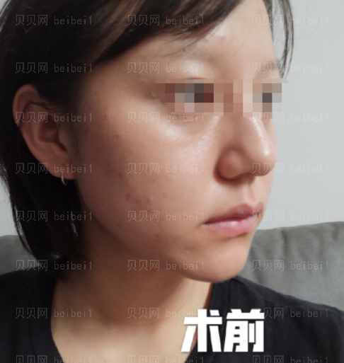 西京医院整形科樊星水光美肤介绍片较新分享_经过这次皮肤治疗,我也有了更大的信心了哦。