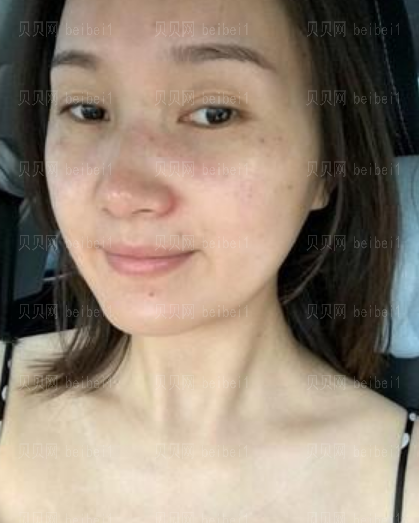 西京医院整形科樊星光子嫩肤介绍片较新分享_皮肤都变得白皙、嫩滑了哦!