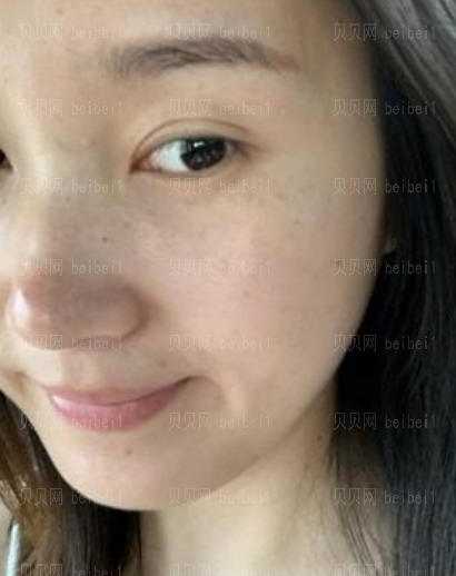 西京医院整形科樊星光子嫩肤介绍片较新分享_皮肤都变得白皙、嫩滑了哦!