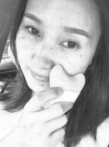 西京医院整形科樊星光子嫩肤介绍片较新分享_皮肤都变得白皙、嫩滑了哦!