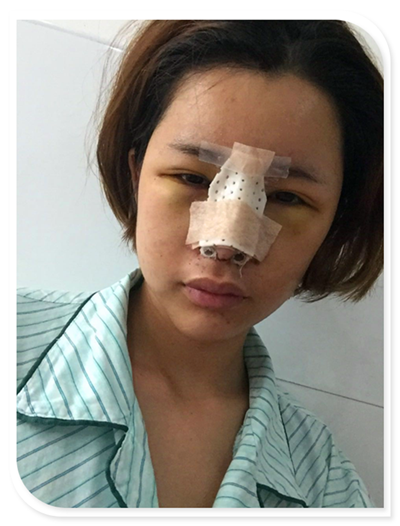 国庆8天长假来啦!亲们怎么打算呢?亲爱的小主你准备好趁这段时间整形了吗?已经有妹子怕国庆人多!赶在国庆前做啦!哈哈~~