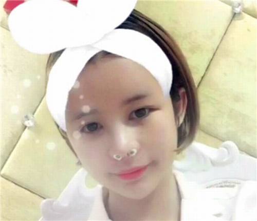 11.11过后,你吃土了吗?钱包瘪了没?,要让自己美美哒先,人美了再去购物,哼唧哼唧!自体脂肪走起!哇卡卡