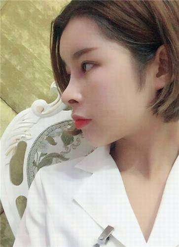 11.11过后,你吃土了吗?钱包瘪了没?,要让自己美美哒先,人美了再去购物,哼唧哼唧!自体脂肪走起!哇卡卡
