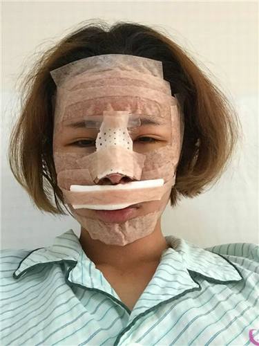 11.11过后,你吃土了吗?钱包瘪了没?,要让自己美美哒先,人美了再去购物,哼唧哼唧!自体脂肪走起!哇卡卡