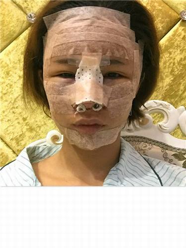11.11过后,你吃土了吗?钱包瘪了没?,要让自己美美哒先,人美了再去购物,哼唧哼唧!自体脂肪走起!哇卡卡