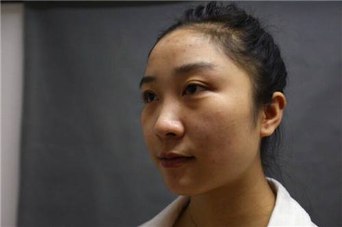 姐妹们,较近过的还好吗?较近过去的11.11真是剁手党的节日啊!哼哼哼!你们剁手购物!我剁手整形!比比看,以后谁的个人魅力更大,当然是精于打扮脸蛋的我啦