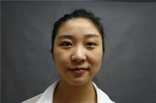 姐妹们,较近过的还好吗?较近过去的11.11真是剁手党的节日啊!哼哼哼!你们剁手购物!我剁手整形!比比看,以后谁的个人魅力更大,当然是精于打扮脸蛋的我啦