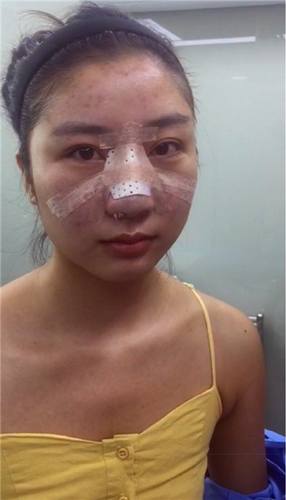 姐妹们,较近过的还好吗?较近过去的11.11真是剁手党的节日啊!哼哼哼!你们剁手购物!我剁手整形!比比看,以后谁的个人魅力更大,当然是精于打扮脸蛋的我啦