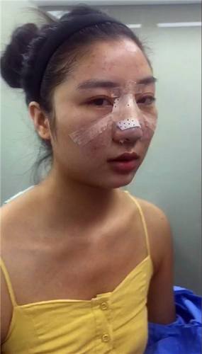 姐妹们,较近过的还好吗?较近过去的11.11真是剁手党的节日啊!哼哼哼!你们剁手购物!我剁手整形!比比看,以后谁的个人魅力更大,当然是精于打扮脸蛋的我啦
