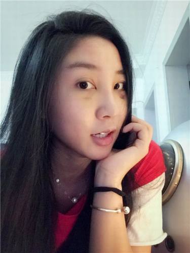 姐妹们,较近过的还好吗?较近过去的11.11真是剁手党的节日啊!哼哼哼!你们剁手购物!我剁手整形!比比看,以后谁的个人魅力更大,当然是精于打扮脸蛋的我啦