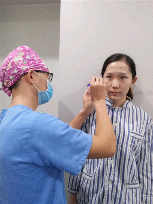 直播我的自体脂肪填充经历,鬼知道我经历了什么?!变美就是要先变鬼,再变美~~~想要做面部填充的美女们先进来看看我的案例哦!!