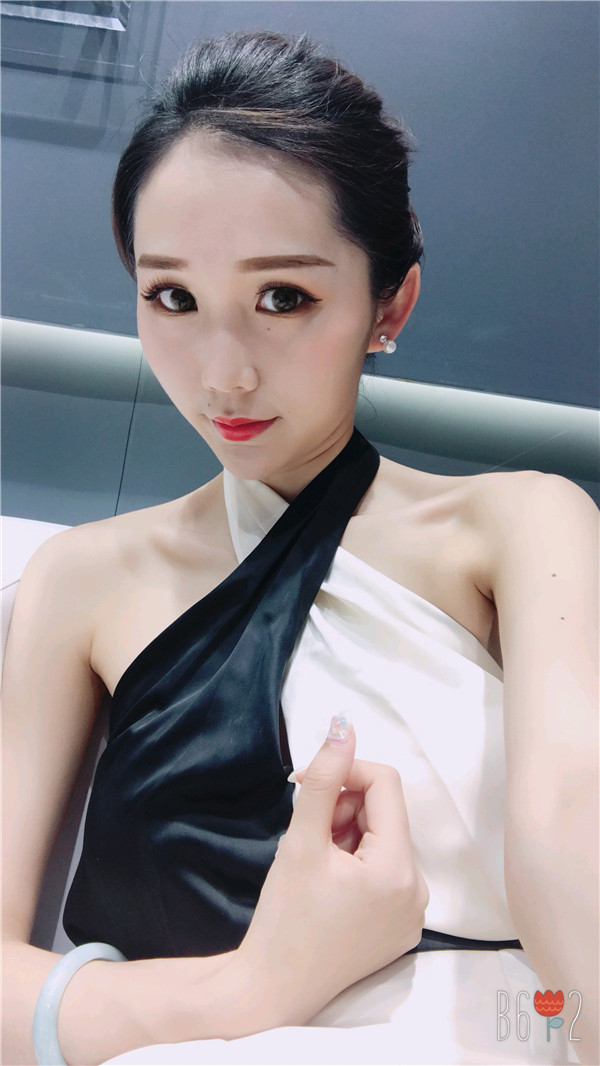 直播我的自体脂肪填充经历,鬼知道我经历了什么?!变美就是要先变鬼,再变美~~~想要做面部填充的美女们先进来看看我的案例哦!!