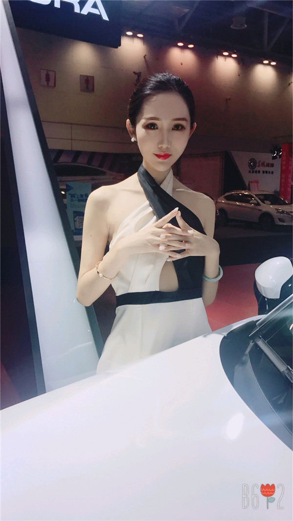 直播我的自体脂肪填充经历,鬼知道我经历了什么?!变美就是要先变鬼,再变美~~~想要做面部填充的美女们先进来看看我的案例哦!!