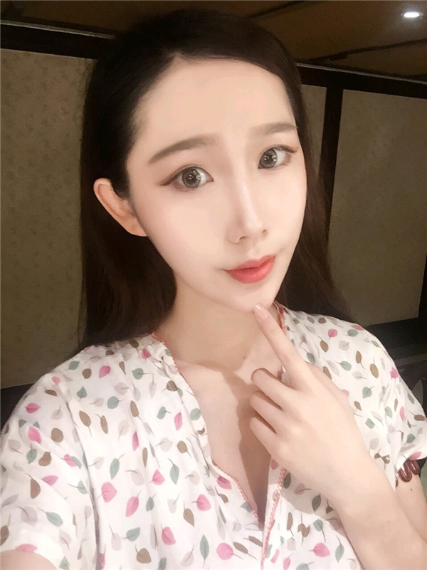 直播我的自体脂肪填充经历,鬼知道我经历了什么?!变美就是要先变鬼,再变美~~~想要做面部填充的美女们先进来看看我的案例哦!!