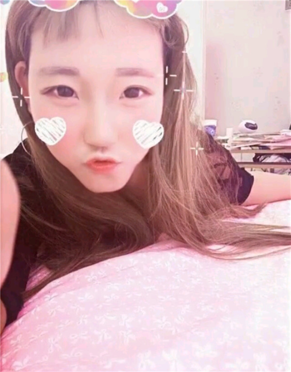 小仙女们,不要做丑女人,要做自己的女神!!双眼皮加苹果肌,一加一等于的果是三哦!速度来围观我的变美案例啦~~~~