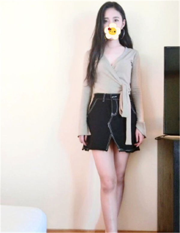 北京韩啸姜辉抽脂术后果怎么样?案例,价格,口碑