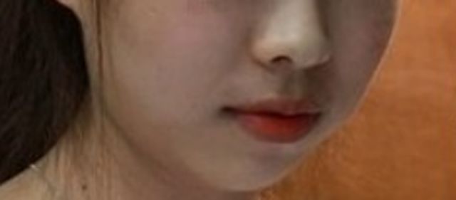 线雕~~~也能瘦脸!