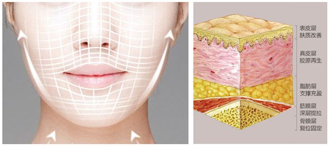 线雕~~~也能瘦脸!