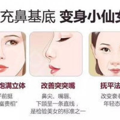 鼻基底有什么填充比较好