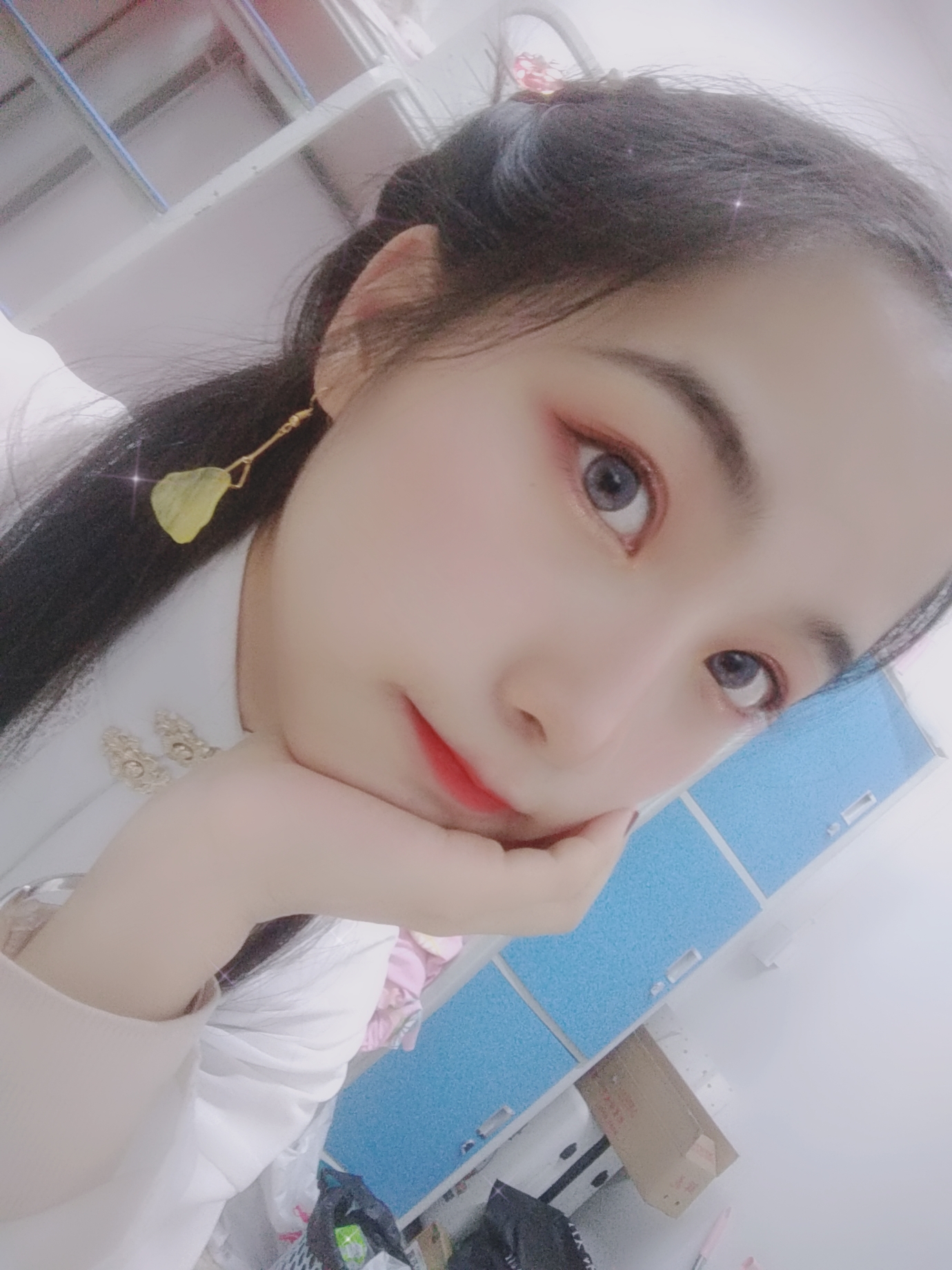 丑小鸭变形记☞双眼皮整形手术