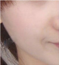 光子嫩肤,做个白嫩美,拴住男人心